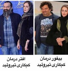 مهراب قاسم خانی قبل و بعد از کم کاری تیروئید | عکس